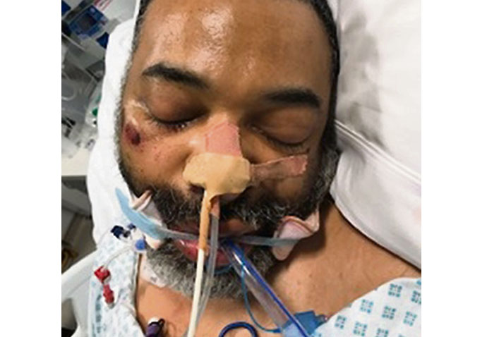 Coma man euston