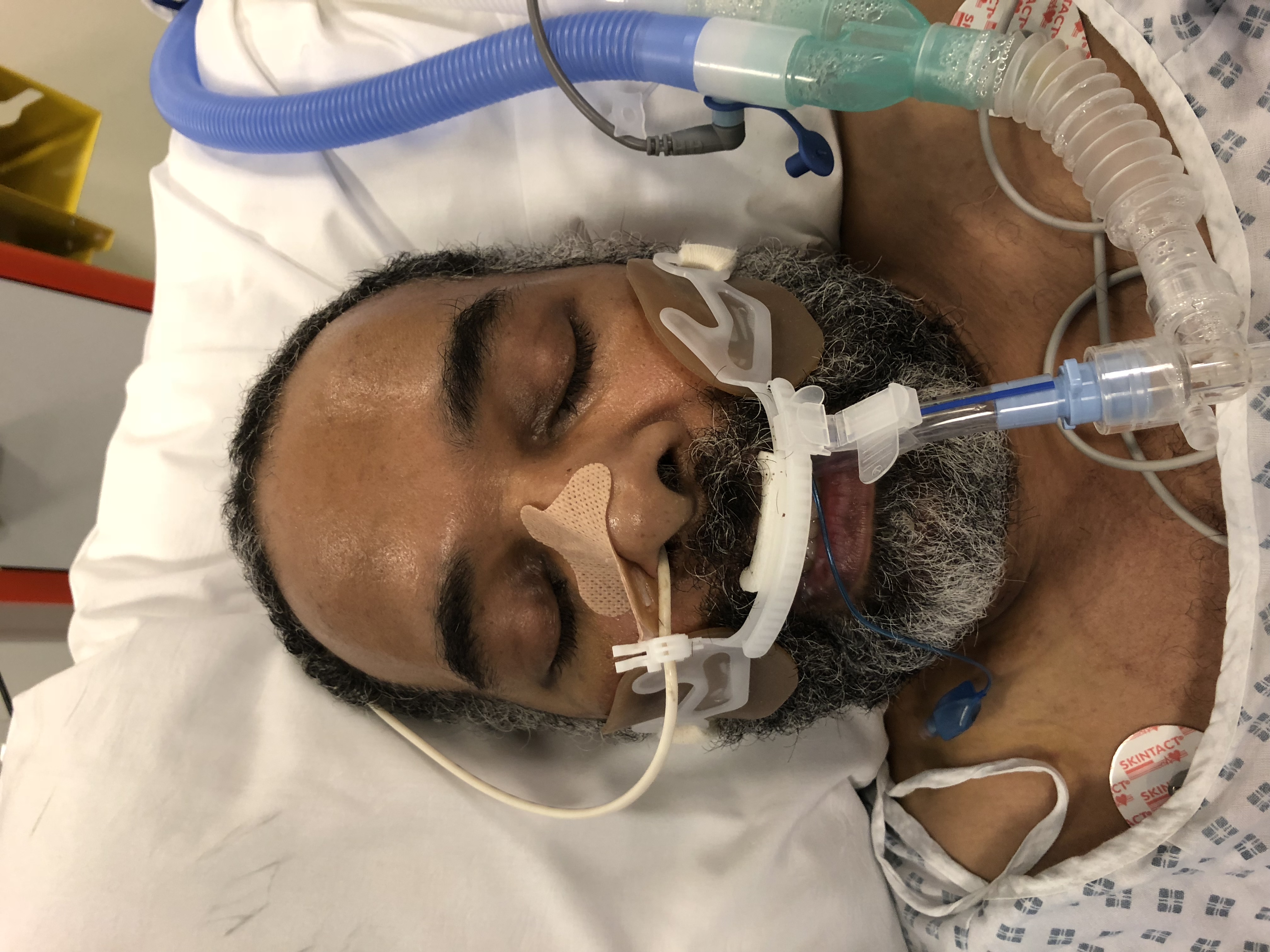 mystery man uclh january 2018
