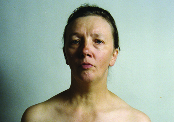 The Picture of Health Jo Spence in collaboration with Rosy Martin Maggie Muray and Terry Dennet 1982 Copyright The Jo Spence Memorial Archive Ryerson University Courtesy MACBA Collection